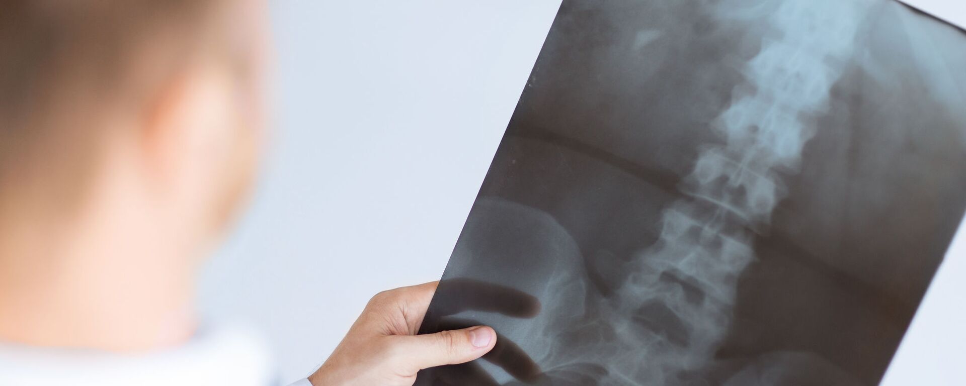 Bác sĩ kiểm tra phim chụp X-quang - Sputnik Việt Nam, 1920, 15.11.2025