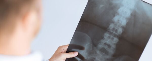 Доктор рассматривает рентген-снимок - Sputnik Việt Nam