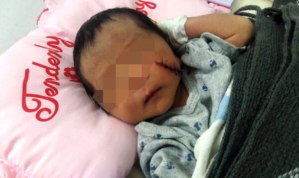 Bé trai sơ sinh bị chôn sống dưới đất hiện đã qua cơn nguy kịch, bú tốt Bé trai sơ sinh bị chôn sống dưới đất hiện đã qua cơn nguy kịch, bú tốt - Sputnik Việt Nam