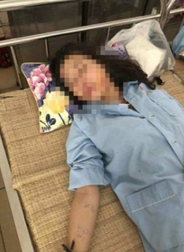 Chị G. sau khi bị đánh đang nằm điều trị tại bệnh viện. - Sputnik Việt Nam