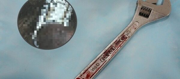 “cậu nhỏ” của bệnh nhân “cậu nhỏ” của bệnh nhân - Sputnik Việt Nam