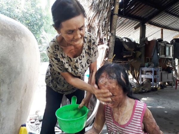 Suốt 6 năm qua, tất cả mọi sinh hoạt hằng ngày của bé N. đều do một tay bà Tâm chăm sóc - Sputnik Việt Nam