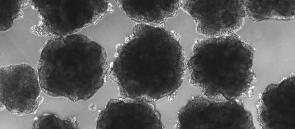 Nhà khoa học Brazil tạo ra bộ não mini với gien người Neanderthal Nhà khoa học Brazil tạo ra bộ não mini với gien người Neanderthal - Sputnik Việt Nam