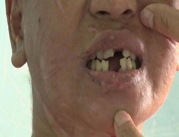 Nạn nhân Y Nhiêu với nhiều vết thương trên người. - Sputnik Việt Nam