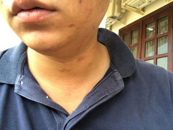 Phóng viên Báo Người Lao Động bị đối tượng đánh gây thương tích - Sputnik Việt Nam