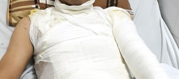 Nạn nhân hiện đang nằm điều trị tại Viện Bỏng quốc gia. Nạn nhân hiện đang nằm điều trị tại Viện Bỏng quốc gia. - Sputnik Việt Nam