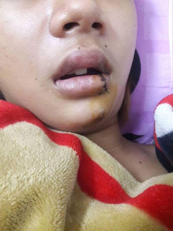 Thiếu nữ 14 tuổi bị truy sát. - Sputnik Việt Nam