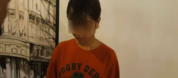 Thiếu nữ phải khâu gần 30 mũi, gãy nửa hàm răng trên, cùng nhiều vết thương khác trên cơ thể. - Sputnik Việt Nam