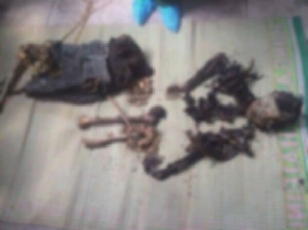 Một tử thi đã phân hủy chỉ còn bộ xương. Một tử thi đã phân hủy chỉ còn bộ xương. - Sputnik Việt Nam