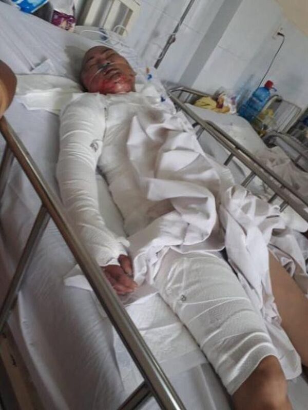 Chị H. đau đớn khi kể lại vụ việc. Chị H. đau đớn khi kể lại vụ việc. - Sputnik Việt Nam