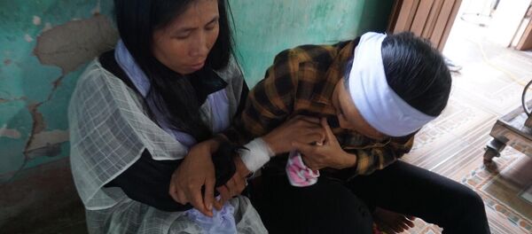 Vết thương do nghi phạm Tiến gây ra cho chị Nguyệt. - Sputnik Việt Nam