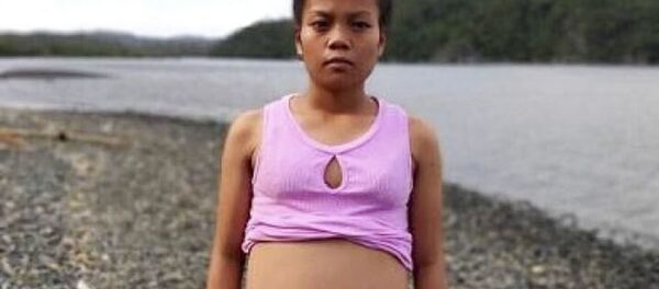 Trong suốt 7 tháng, bụng của Kimberly, 17 tuổi, ngày càng phình to, và cân nặng của cô tăng hẳn 10kg. - Sputnik Việt Nam