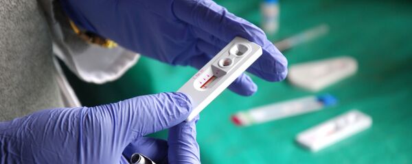 HIV - Sputnik Việt Nam