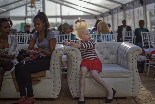 Cuộc thi sắc đẹp dành cho người bạch tạng “Mr. & Miss Albinism East Africa” ở Kenya Cuộc thi sắc đẹp dành cho người bạch tạng “Mr. & Miss Albinism East Africa” ở Kenya - Sputnik Việt Nam