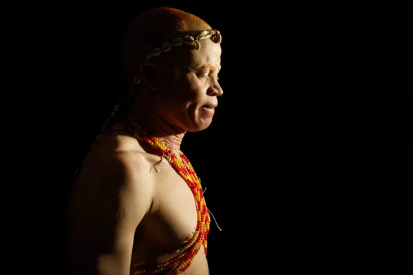 Cuộc thi sắc đẹp dành cho người bạch tạng “Mr. & Miss Albinism East Africa” ở Kenya Cuộc thi sắc đẹp dành cho người bạch tạng “Mr. & Miss Albinism East Africa” ở Kenya - Sputnik Việt Nam