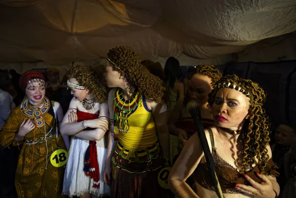 Cuộc thi sắc đẹp dành cho người bạch tạng “Mr. & Miss Albinism East Africa” ở Kenya Cuộc thi sắc đẹp dành cho người bạch tạng “Mr. & Miss Albinism East Africa” ở Kenya - Sputnik Việt Nam
