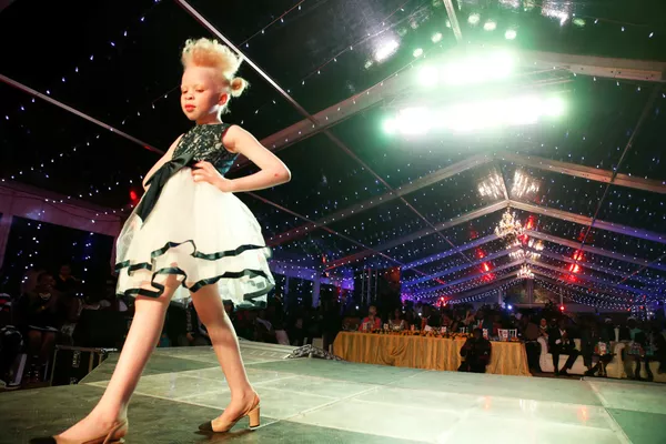 Cuộc thi sắc đẹp dành cho người bạch tạng “Mr. & Miss Albinism East Africa” ở Kenya Cuộc thi sắc đẹp dành cho người bạch tạng “Mr. & Miss Albinism East Africa” ở Kenya - Sputnik Việt Nam