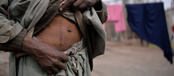 Người đàn ông Pakistan với vết mổ lấy thận đem bán - Sputnik Việt Nam