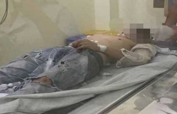 Nam thanh niên đang được điều trị tại bệnh viện - Sputnik Việt Nam