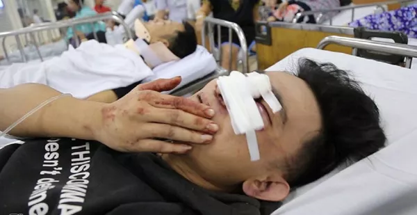 Nhiều người bị thương được đưa đi cấp cứu. Nhiều người bị thương được đưa đi cấp cứu. - Sputnik Việt Nam