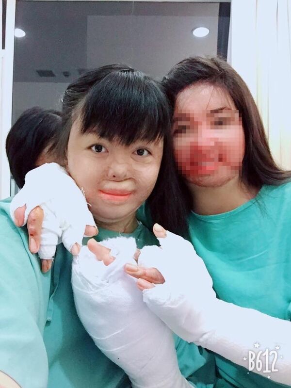 Trải qua 16 lần phẫu thuật, gương mặt Dung đã dần xinh đẹp trở lại.  - Sputnik Việt Nam