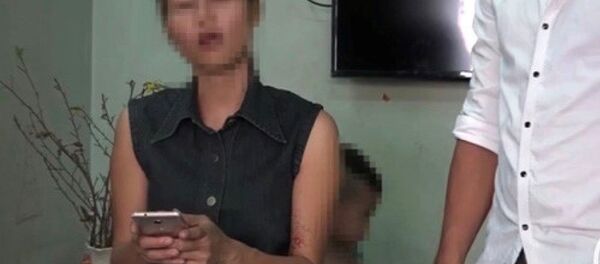 Chị B. kể lại vụ việc chiếc micro hát karaoke phát nổ. - Sputnik Việt Nam