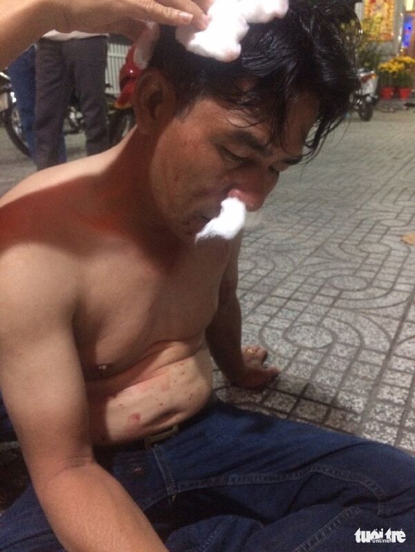 Sau khi bị 2 anh em Công an TP Châu Đốc đánh liên tục thì ông Hải bị đa chấn thương phải đưa đi cấp cứu - Sputnik Việt Nam