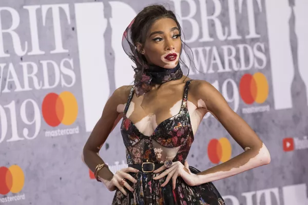 Người mẫu Winnie Harlow tại lễ trao giải Brit Awards ở London Người mẫu Winnie Harlow tại lễ trao giải Brit Awards ở London - Sputnik Việt Nam