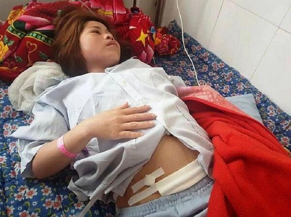 Bệnh nhân mổ ruột thừa bị cắt luôn vòi trứng ở Hà Tĩnh - Sputnik Việt Nam