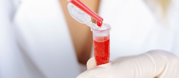 Xét nghiệm máu Xét nghiệm máu - Sputnik Việt Nam