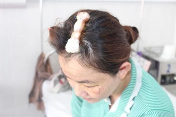 Xét hành vi phòng vệ chính đáng của người vợ giết kẻ đột nhập vào nhà - Sputnik Việt Nam