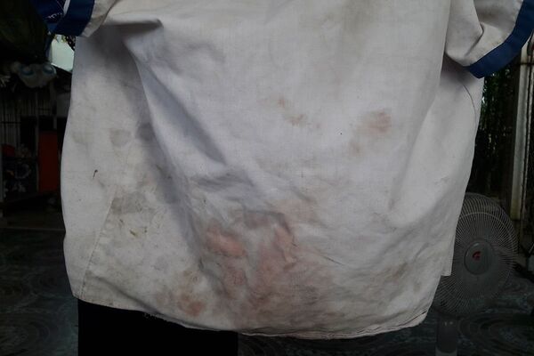 Bé gái lớp 2 nghi bị xâm hại ở Nghệ An: Giả chết để bảo toàn tính mạng - Sputnik Việt Nam