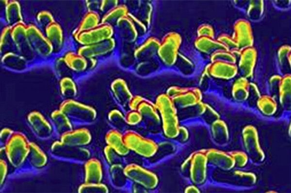 Tại sao vi khuẩn dịch hạch không thể bị diệt trừ hoàn toàn trên hành tinh - Sputnik Việt Nam