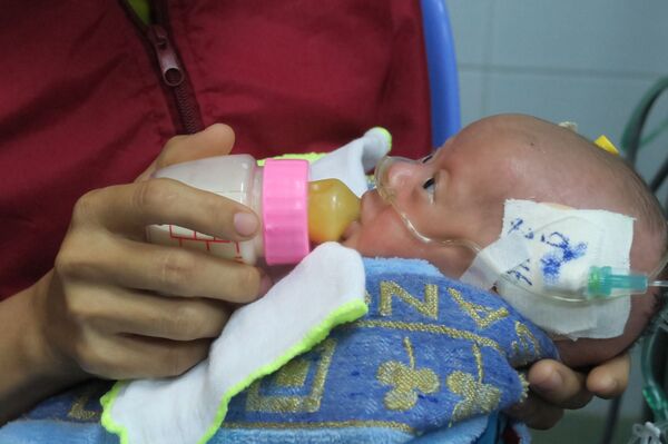 Mổ tim hở cho bé gái chỉ nặng 1,6kg - Sputnik Việt Nam