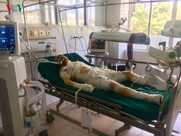 Người đàn ông tẩm xăng đốt 5 người một nhà: Sức khỏe các nạn nhân giờ ra sao? Người đàn ông tẩm xăng đốt 5 người một nhà: Sức khỏe các nạn nhân giờ ra sao? - Sputnik Việt Nam