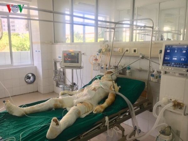 Người đàn ông tẩm xăng đốt 5 người một nhà: Sức khỏe các nạn nhân giờ ra sao? Người đàn ông tẩm xăng đốt 5 người một nhà: Sức khỏe các nạn nhân giờ ra sao? - Sputnik Việt Nam