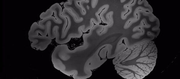 bộ não bộ não - Sputnik Việt Nam