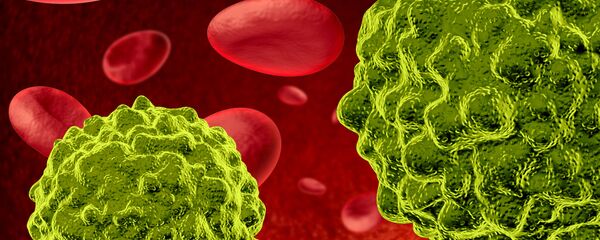 Ung thư - Sputnik Việt Nam