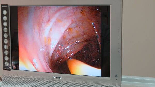 Cấy phân: phương pháp điều trị mới nhất hay chỉ là một cơn điên cuồng? Cấy phân: phương pháp điều trị mới nhất hay chỉ là một cơn điên cuồng? - Sputnik Việt Nam