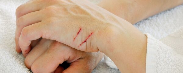 Hai vết xước trên tay - Sputnik Việt Nam