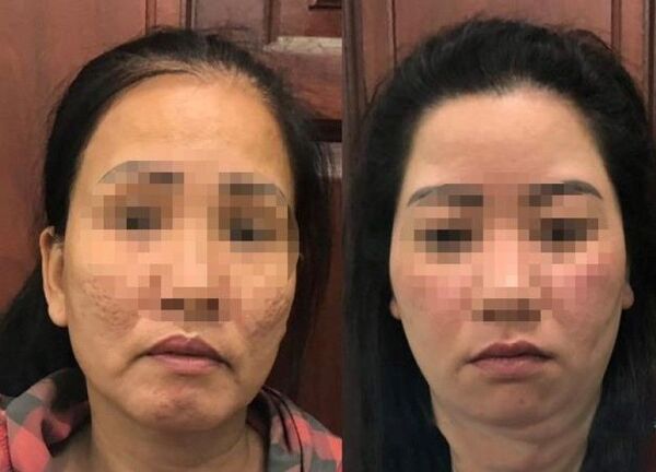 Bắt giữ hai gái mại dâm đã thực hiện trót lọt nhiều vụ trộm cắp tài sản - Sputnik Việt Nam