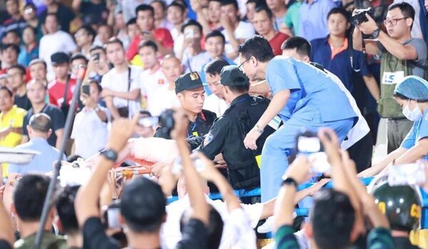 Đi xem trận Hà Nội FC rồi phải phẫu thuật 2 lần: Nữ hâm mộ bị bỏng vì pháo sáng Đi xem trận Hà Nội FC rồi phải phẫu thuật 2 lần: Nữ hâm mộ bị bỏng vì pháo sáng - Sputnik Việt Nam