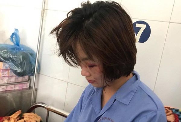 Nữ phụ xe buýt bị nhóm thanh niên đánh hội đồng dã man  - Sputnik Việt Nam