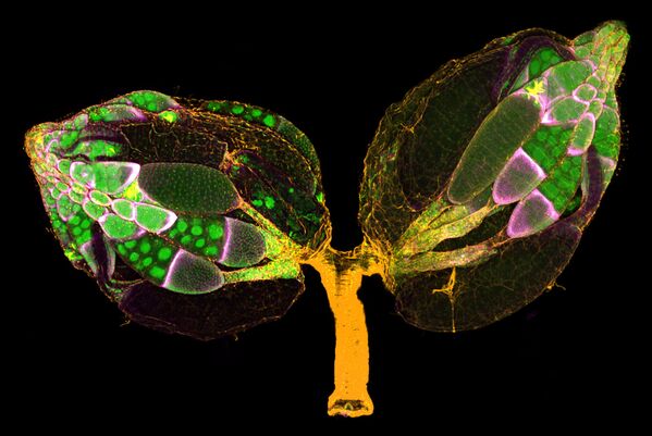 Trứng ruồi dấm của hai nhiếp ảnh gia Mỹ Yujin Chen & Dr. Jocelyn McDonald,  giành vị trí thứ 11 trong cuộc thi ảnh Nikon Small World 2019 - Sputnik Việt Nam