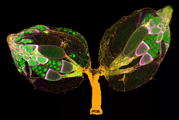 Trứng ruồi dấm của hai nhiếp ảnh gia Mỹ Yujin Chen & Dr. Jocelyn McDonald, giành vị trí thứ 11 trong cuộc thi ảnh Nikon Small World 2019 Trứng ruồi dấm của hai nhiếp ảnh gia Mỹ Yujin Chen & Dr. Jocelyn McDonald, giành vị trí thứ 11 trong cuộc thi ảnh Nikon Small World 2019 - Sputnik Việt Nam