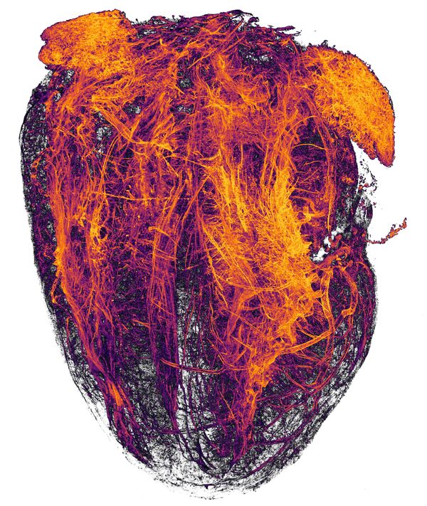 Hình ảnh mạch máu tim chuột sau nhồi máu cơ tim của Simon Merz, Lea Bornemann và Sebastian Korste, giành vị trí thứ 20 trong cuộc thi ảnh Nikon Small World 2019 - Sputnik Việt Nam