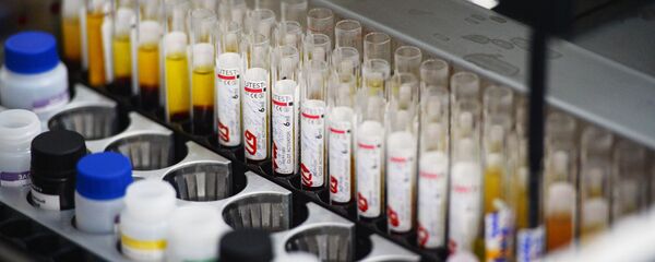 Лаборатория иммуноферментных исследований, где проходит исследование крови на инфекции (гепатит, сифилис, ВИЧ) Лаборатория иммуноферментных исследований, где проходит исследование крови на инфекции (гепатит, сифилис, ВИЧ) - Sputnik Việt Nam