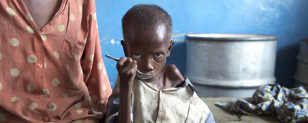 Em bé suy dinh dưỡng trong bệnh viện Cabinda, Congo Em bé suy dinh dưỡng trong bệnh viện Cabinda, Congo - Sputnik Việt Nam