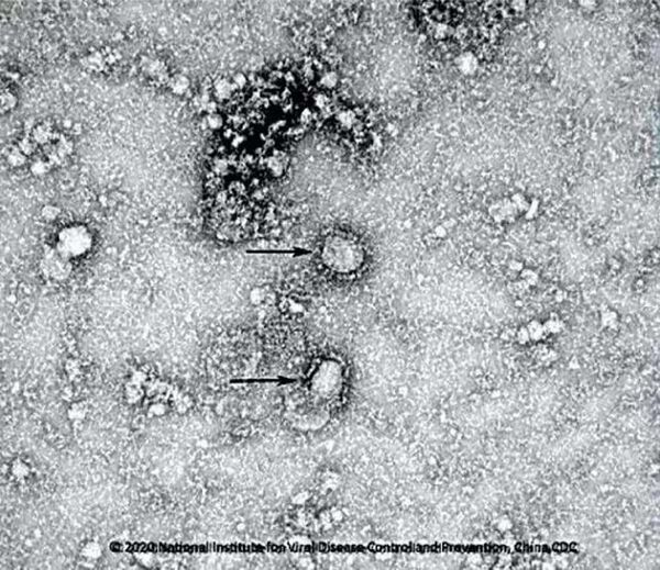 Việt Nam ghi nhận trường hợp thứ 13 dương tính với virus Corona Việt Nam ghi nhận trường hợp thứ 13 dương tính với virus Corona - Sputnik Việt Nam