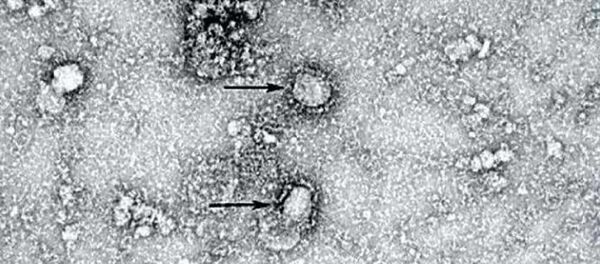 Coronavirus Coronavirus - Sputnik Việt Nam